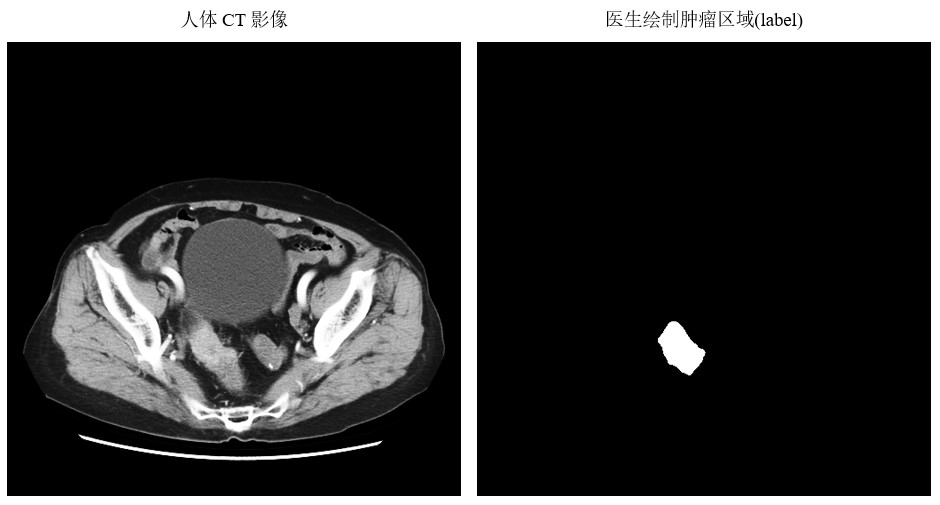 图1 数据示意图