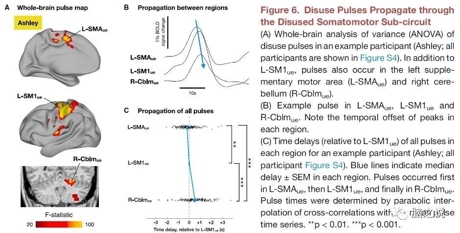 Neuron：人脑废用神经环路中的可塑性与自发活动脉冲