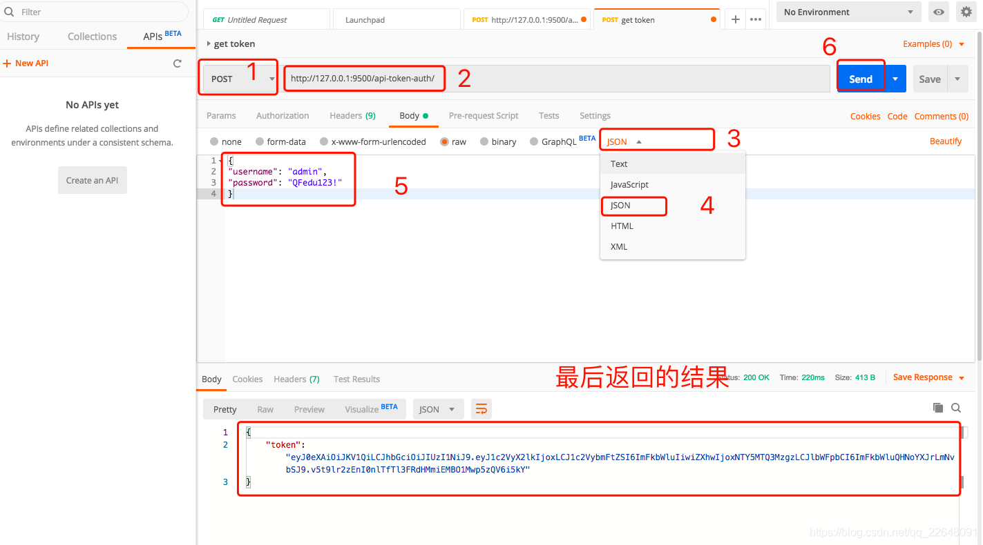 [Error en la transferencia de la imagen del enlace externo. El sitio de origen puede tener un mecanismo de enlace anti-sanguijuela. Se recomienda guardar la imagen y subirla directamente (img-IonrVJLZ-1599822683459) (evernotecid: // BBD579E0-7127-4377-8E81-47BEA574FA91 / appyourceinxiangcom / 25594833 / p709)]