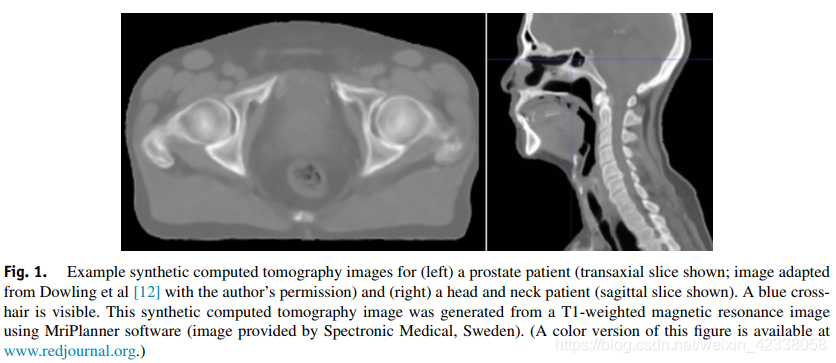 Reference Reading Mri Only放射治疗的synthetic Ct 生成方法的系统综述 Peanut 的博客 Csdn博客