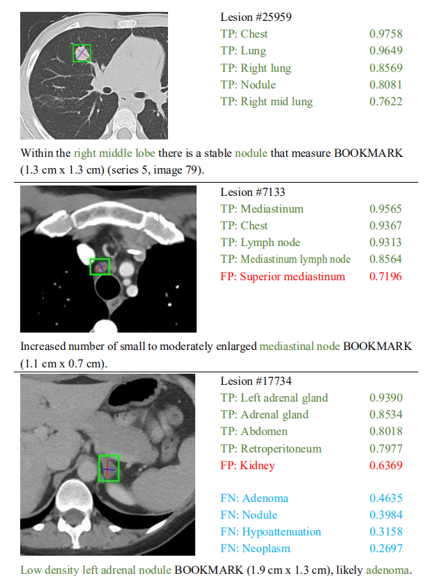 多标签分类(六):Fine-Grained Lesion Annotation in CT Images with Knowledge Mined From Radiology Reports