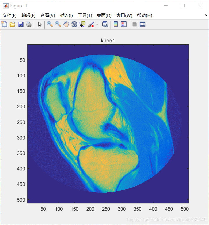 Matlab Ct Model MATLAB对CT图读取,写入
