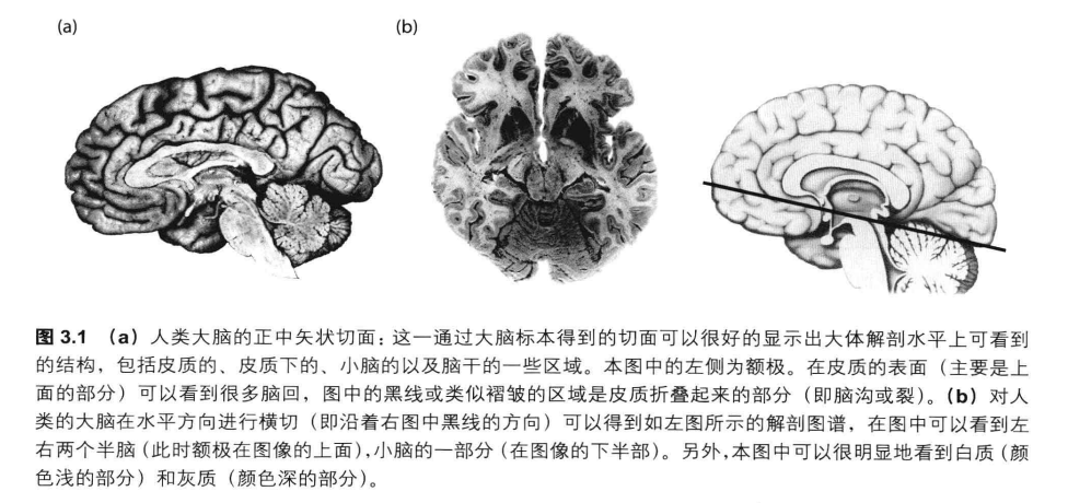 脑灰质与脑白质影像图图片