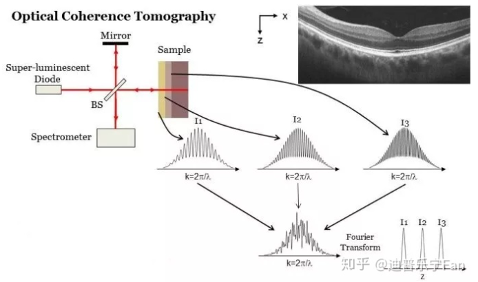 频域光学相干层析成像_光学相干层析成像「建议收藏」