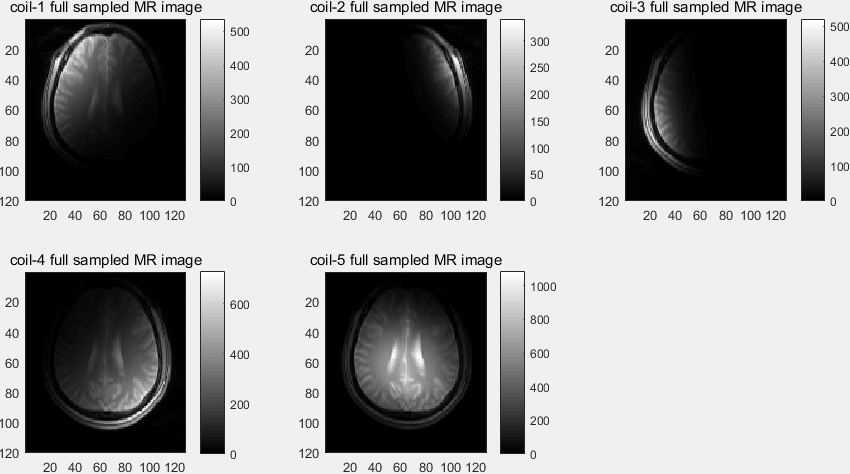 【MRI】SENSE (Sensitivity Encoding) 算法 仿真实验与原理剖析 (Matlab 实现)_down ...