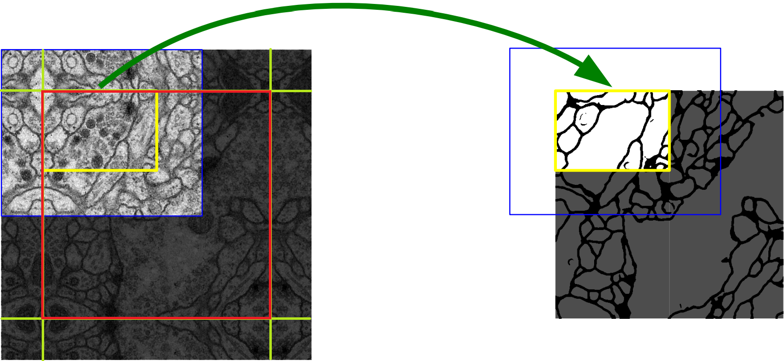 U net. UNET нейронная сеть. Сверточная нейронная сеть алгоритм. UNET Segmentation. Biomedical Imaging Segmentation.