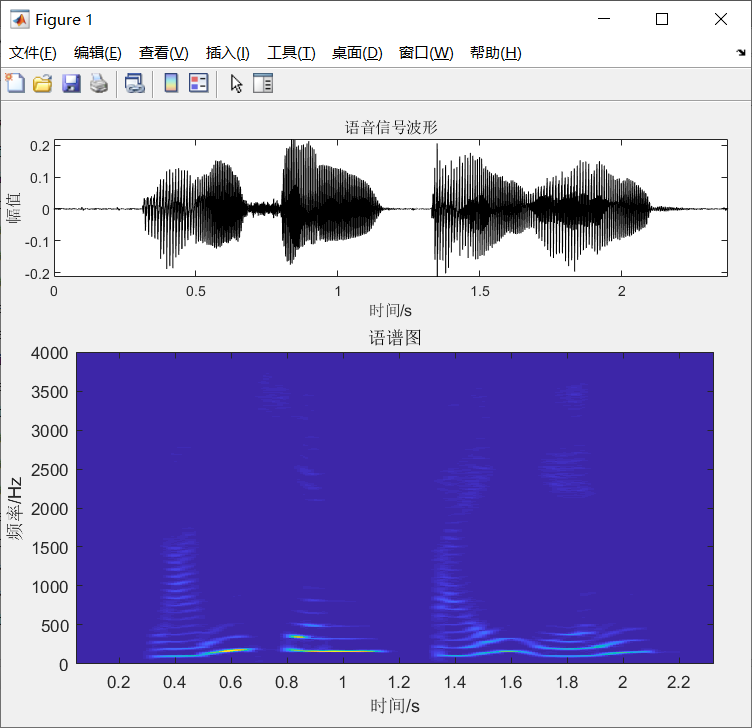 MATLAB识别曲谱_图片识别人物