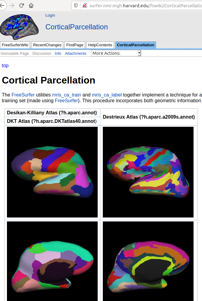 【freesurfer学习1】freesurfer结构像批处理-CSDN博客