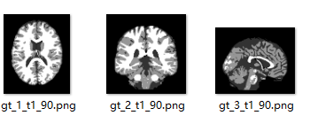 BrainWeb: Simulated Brain Database使用（原图以及GroundTruth切片可视化）和矢状冠状横断面