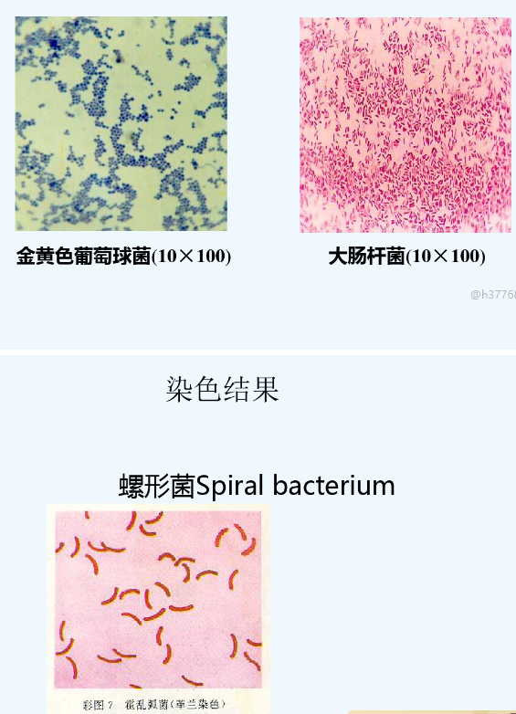 革兰氏染色结果图片