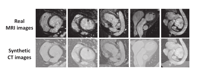 Towards Cross-Modality Medical Image Segmentation with Online Mutual ...