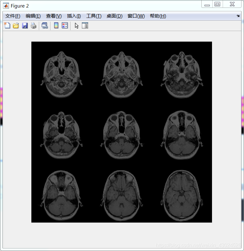 【MATLAB Image Processing Toolbox 入门教程九】“导入、导出和转换”之“图像序列和批处理”_matlab中 ...