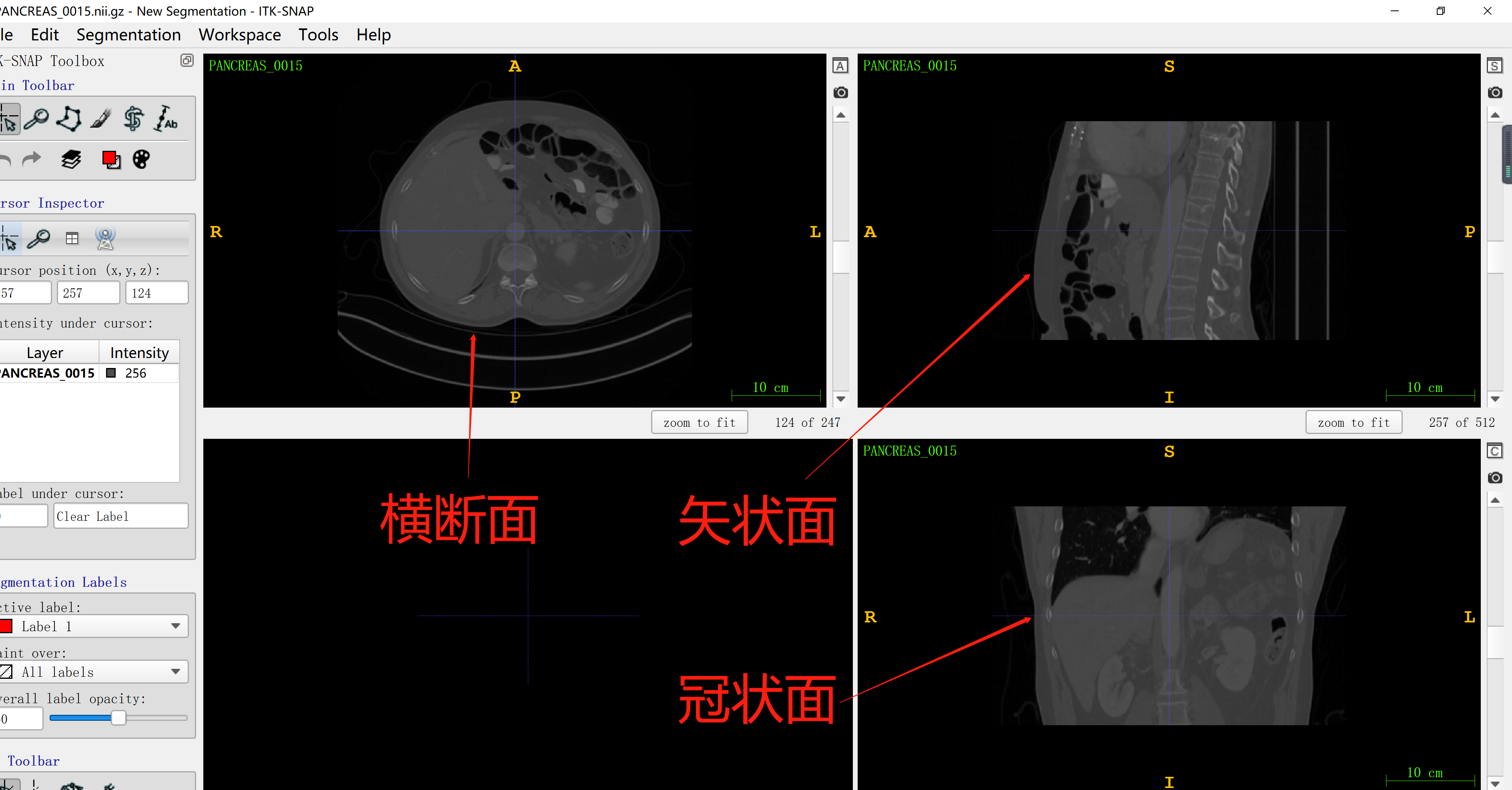 医学图像预处理之可视化