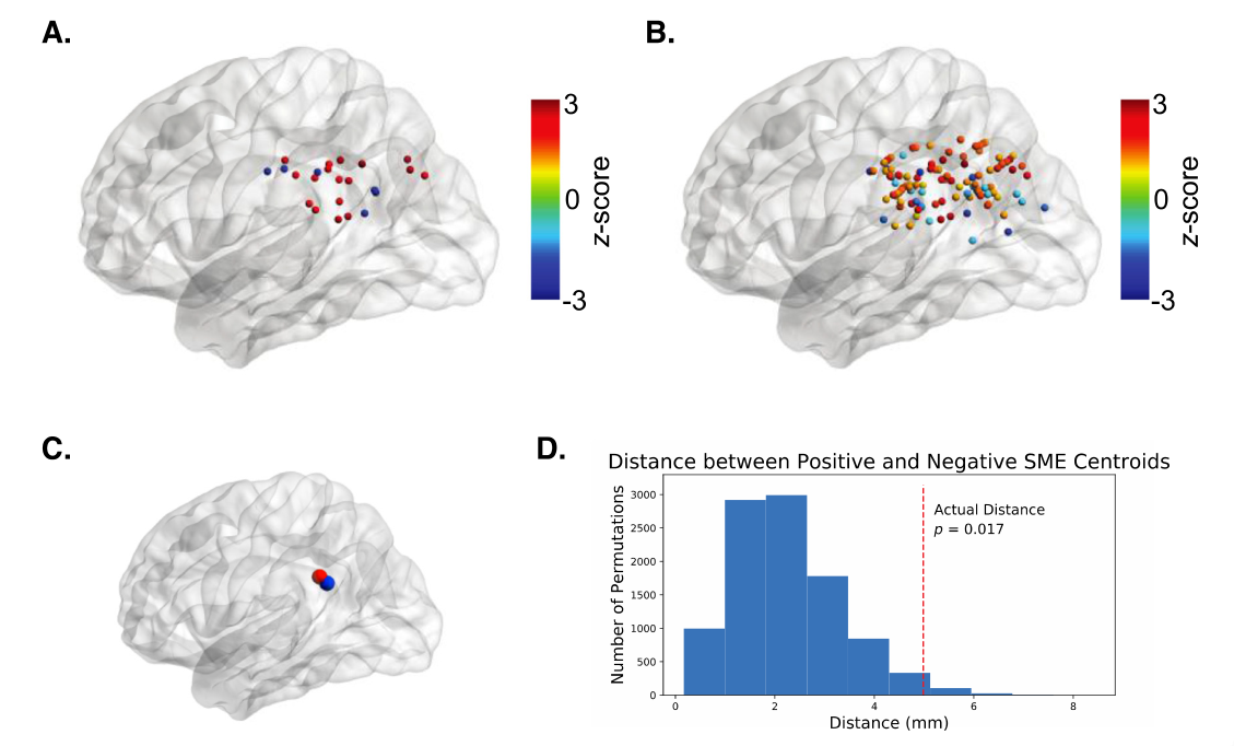 NeuroImage：左缘上回和角回对情景记忆编码的贡献：一项颅内脑电图研究-CSDN博客
