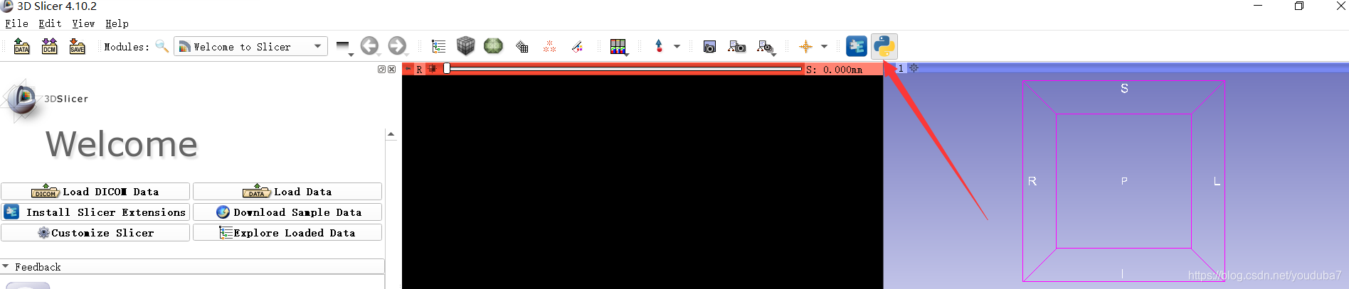 给3D Slicer的Python插件加OpenCV库_slicer python插件开发-CSDN博客