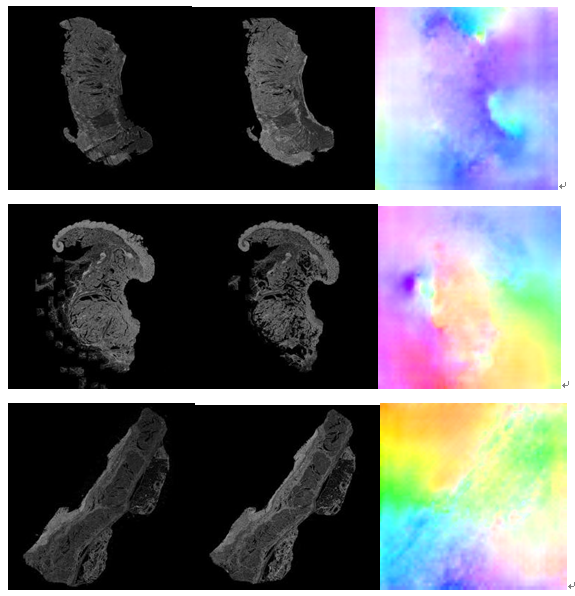 二维图像配准flowfield可视化