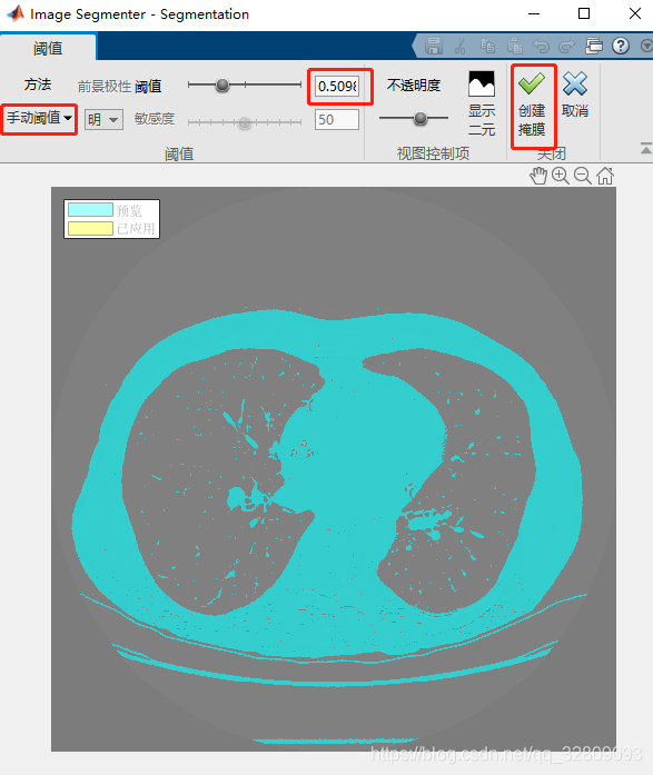 基于Matlab的3-D胸部扫描CT切片的肺部分割——使用活动轮廓(snakes)进行三维分割及建模_肺部ct 3d建模-CSDN博客