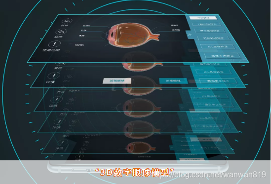 3D数字眼球模型