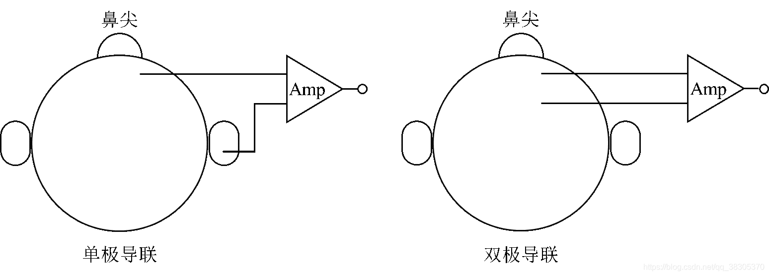 图1 EEG导联