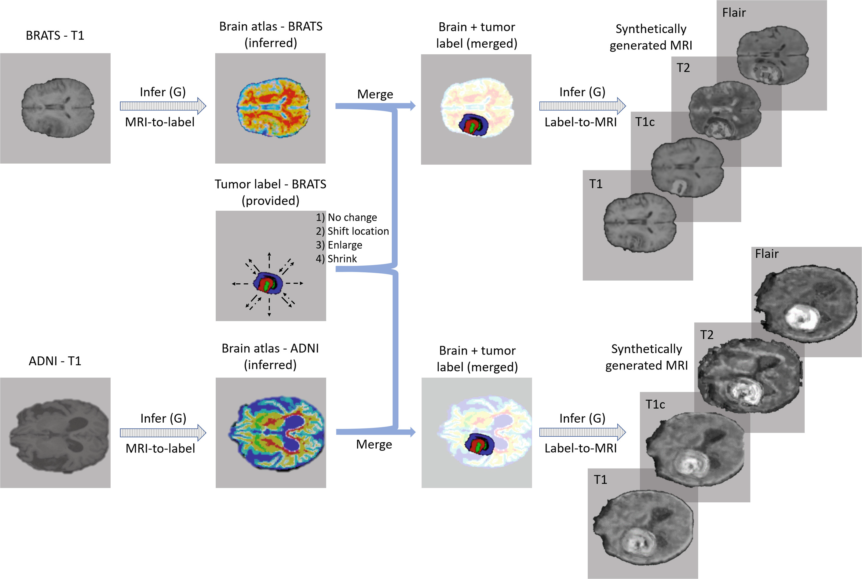 Medical Image Synthesis for Data Augmentation and Anonymization-CSDN博客