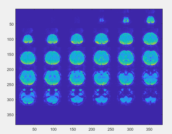 关于不同扫描设备得到fmri、T1像的异同_t1结构像_赤井的博客-CSDN博客