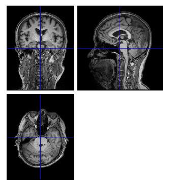 关于不同扫描设备得到fmri、T1像的异同_fmri和t1-CSDN博客
