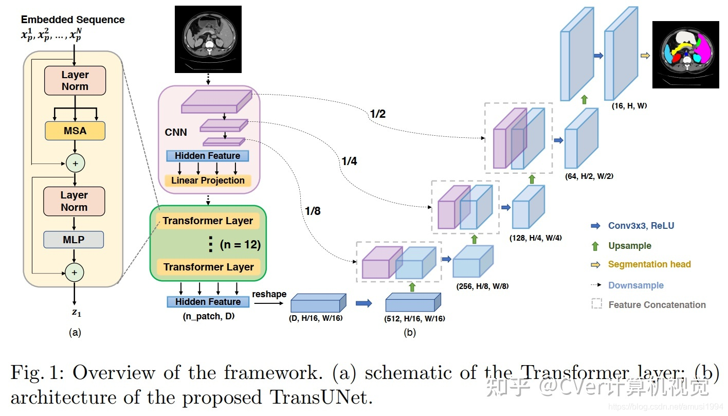 TransUNet: Transformers Make Strong Encoders for Medical Image ...
