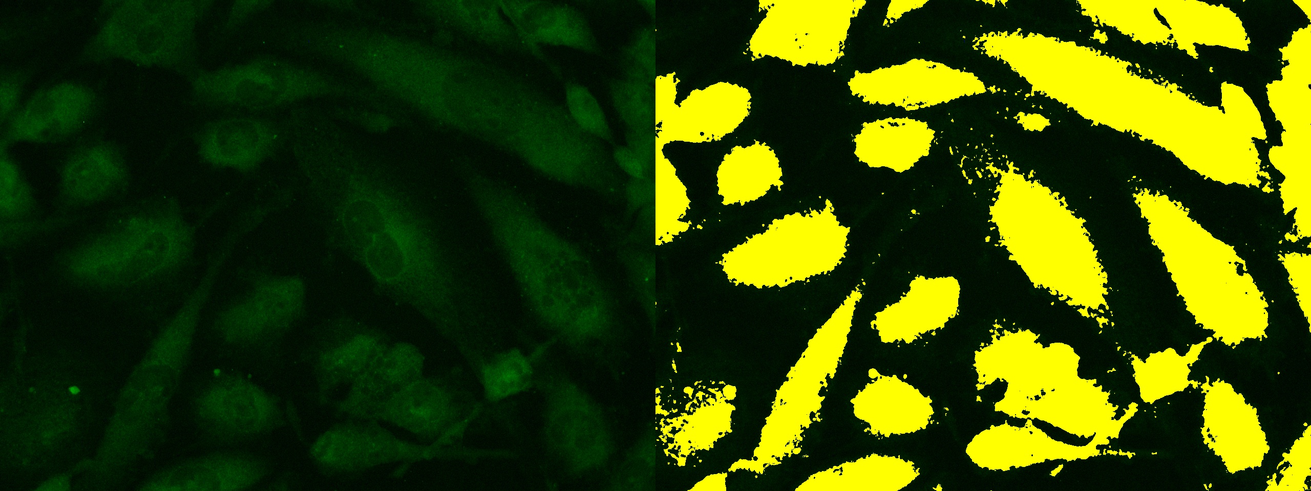 荧光染色切片病理分析算法(深度学习 机器学习)