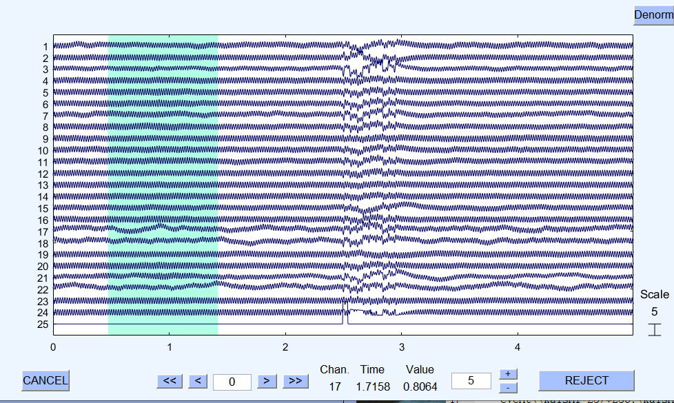 EEGLAB使用流程-CSDN博客