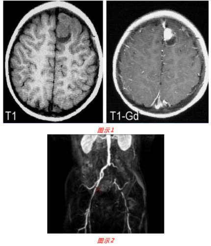 Gd-DTPA钆元素钆元素对比磁共振造影剂 氟-19磁共振/荧光双模态显影剂19F MRI_dtpa的粒径_齐岳生物科技在线的博客-CSDN博客