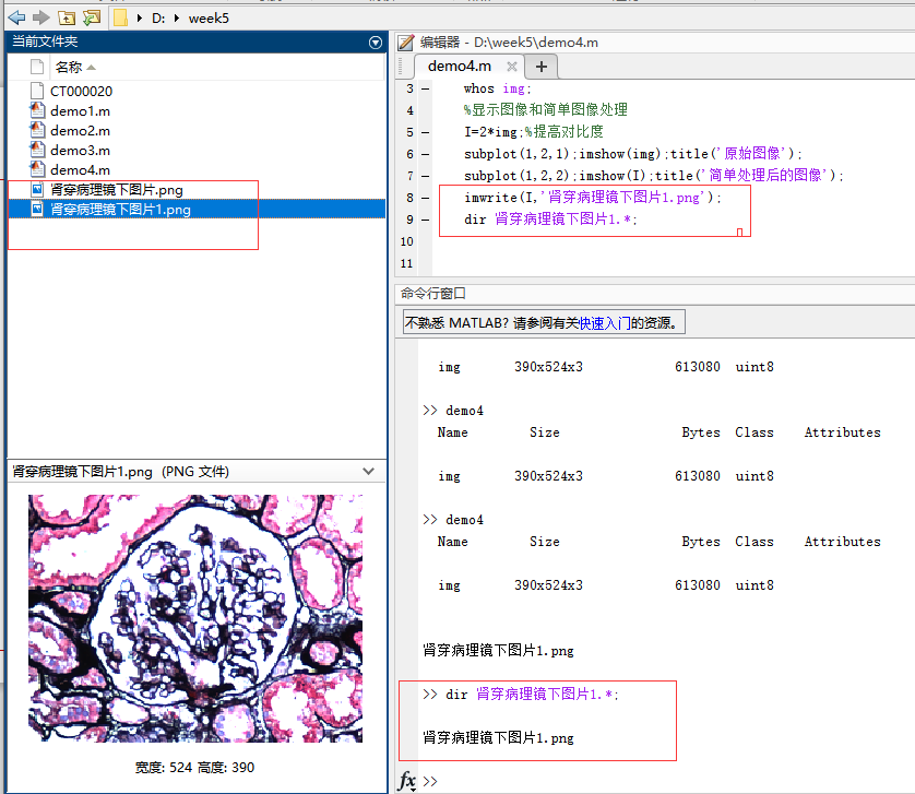 matlab—医学图像读取(1)