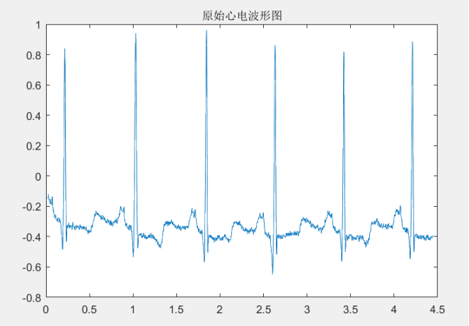 Matlab心电信号预处理