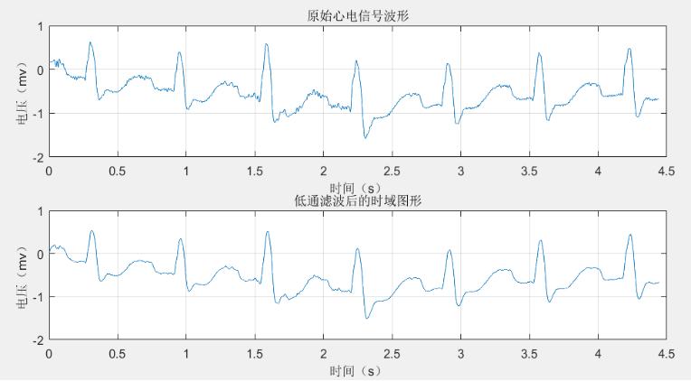 Matlab心电信号预处理-CSDN博客