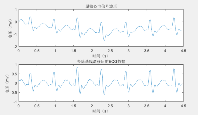 Matlab心电信号预处理