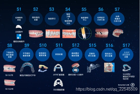 S系列颌位重建