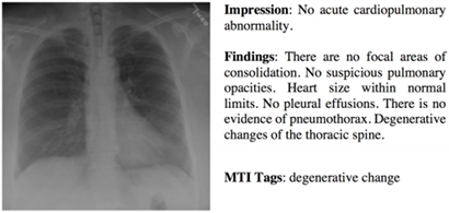 胸部X线检查的报告中，impression是一句话，findings是一段话，而tags是一个关键词的列表。