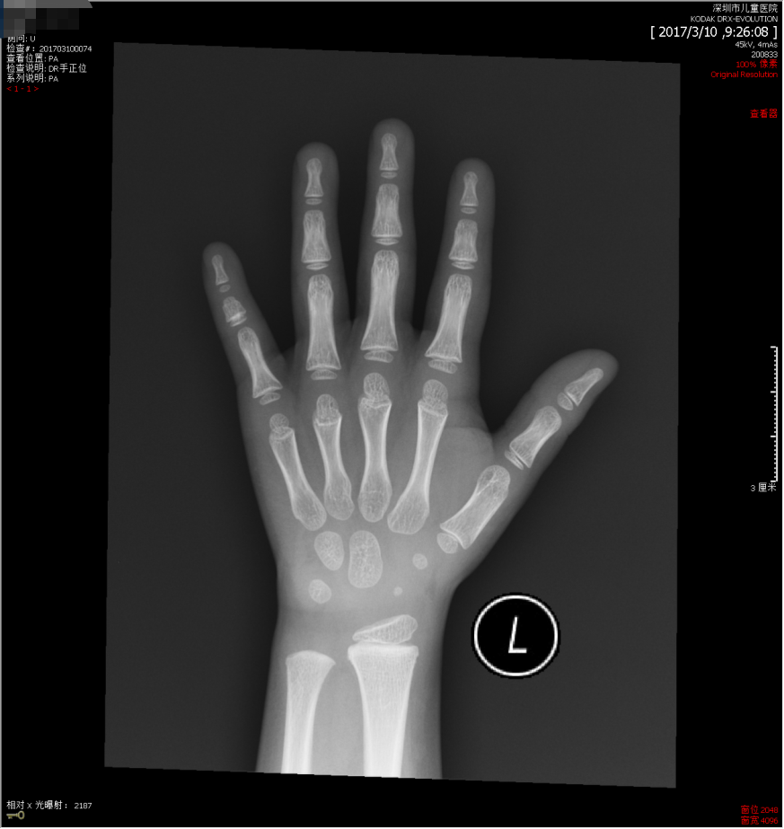 python-OpenCV-多边形拟合_python approxpolydp-CSDN博客