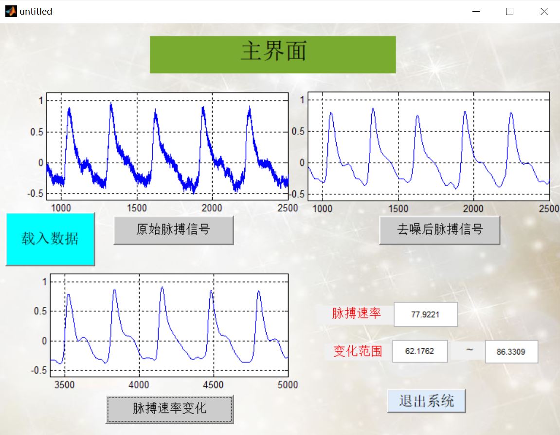 【肌电信号】基于matlab GUI脉搏信号分析(去噪+特征提取)【含Matlab源码 862期】