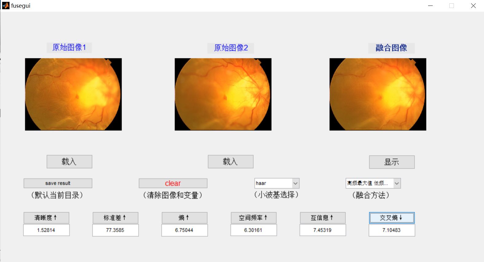 【图像融合】基于matlab GUI区域分割图像融合（融合指标）【含Matlab源码 866期】