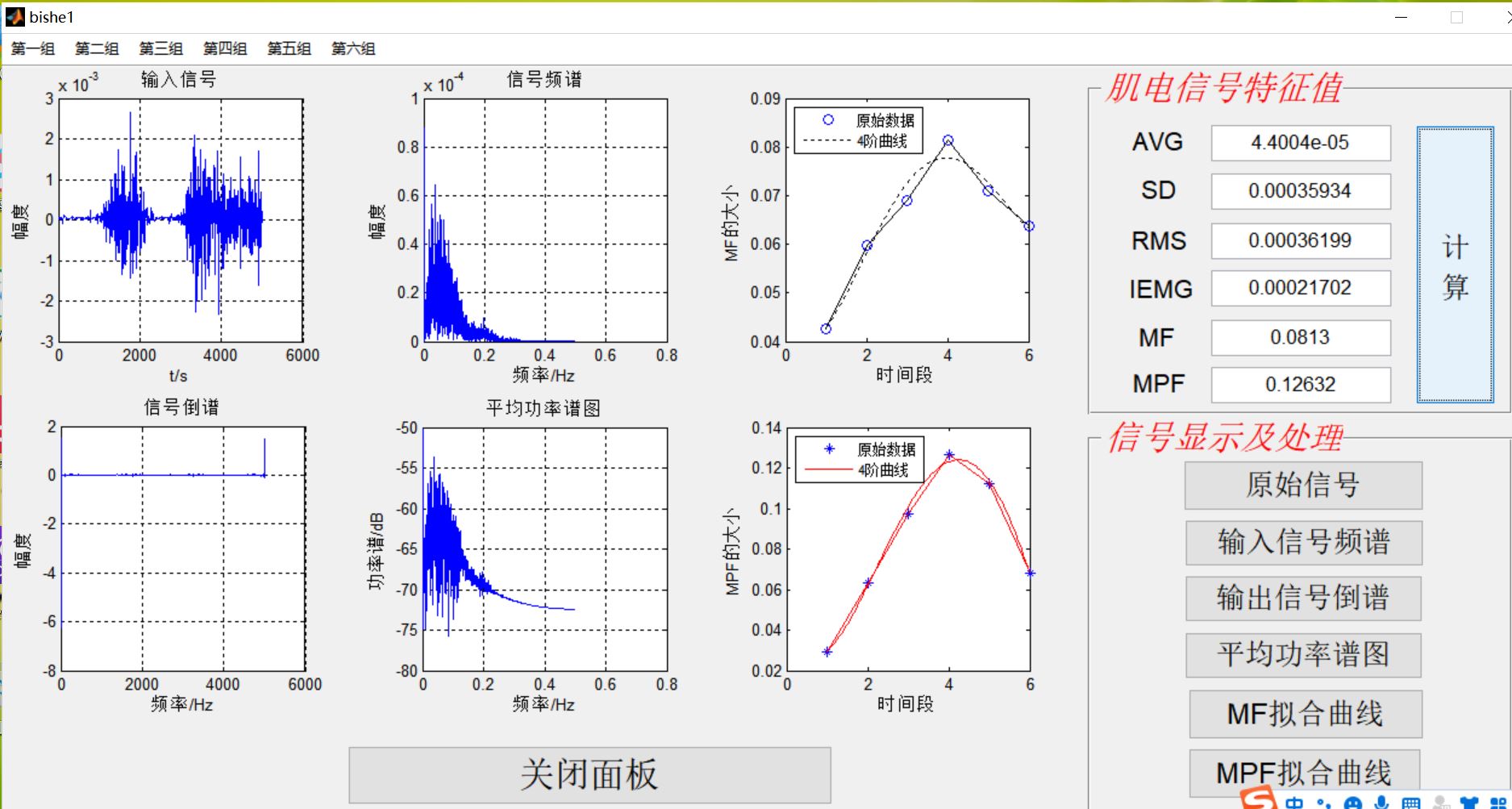 【肌电信号】基于matlab GUI肌电信号处理【含Matlab源码 966期】