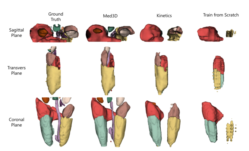 1,三个面:矢状平面 sagittal plane 看解剖体左右方位 x横向平面
