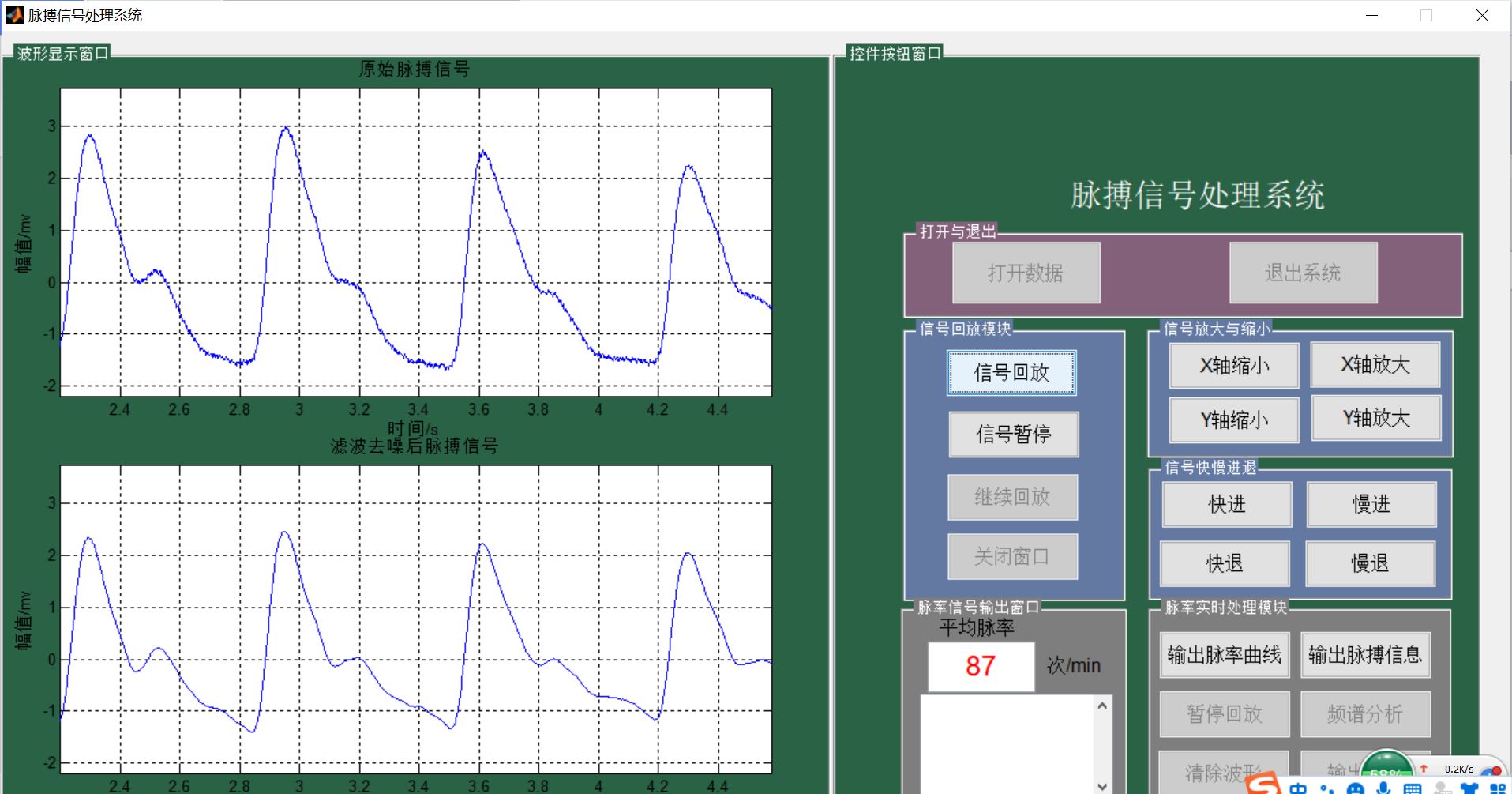 【肌电信号】基于matlab GUI脉搏信号处理系统【含Matlab源码 1062期】