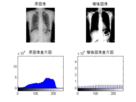 【胸片分割】基于matlab GUI最小误差法胸片分割系统【含Matlab源码 1065期】