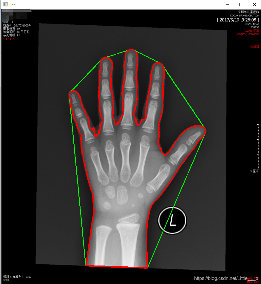 Opencv Hull Contours OpenCV——图像轮廓2_cv2.contourarea(i)_Little___c的博客-CSDN博客
