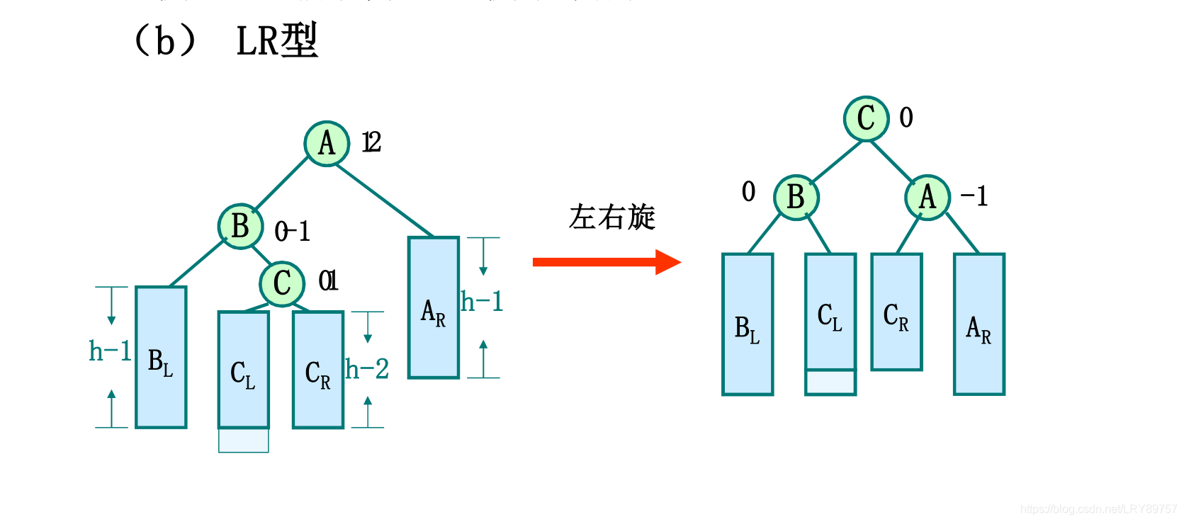 LR型