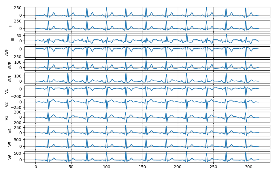 基于Python的心电图上位机诊断软件_设计一个上位机软件,对心电信号或脉搏信号的数据集进行加载,显示相应波形-CSDN博客