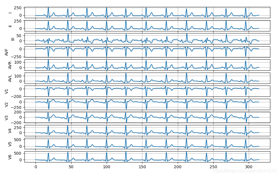 基于Python的心电图上位机诊断软件_设计一个上位机软件,对心电信号或脉搏信号的数据集进行加载,显示相应波形-CSDN博客
