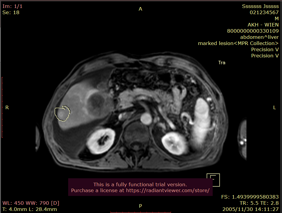 python显示DICOM中overlay数据_pydicom overlay-CSDN博客