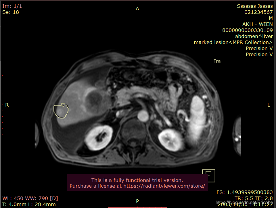 python显示DICOM中overlay数据_pydicom overlay-CSDN博客