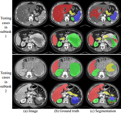 AbdomenCT-1K: Is Abdominal Organ Segmentation A Solved Problem?-CSDN博客